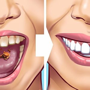 28 EASY TEETH HACKS THAT WORK MAGIC