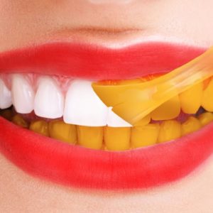 30 LIFE HACKS FOR A HOLLYWOOD SMILE