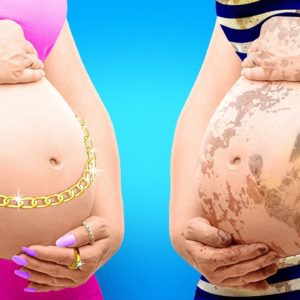 RICH MOM vs POOR MOM || TOP PREGNANCY HACKS & PARENTING TIPS