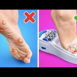 Useful Feet Gadgets and Hacks || Amazing Pedicure Transformation